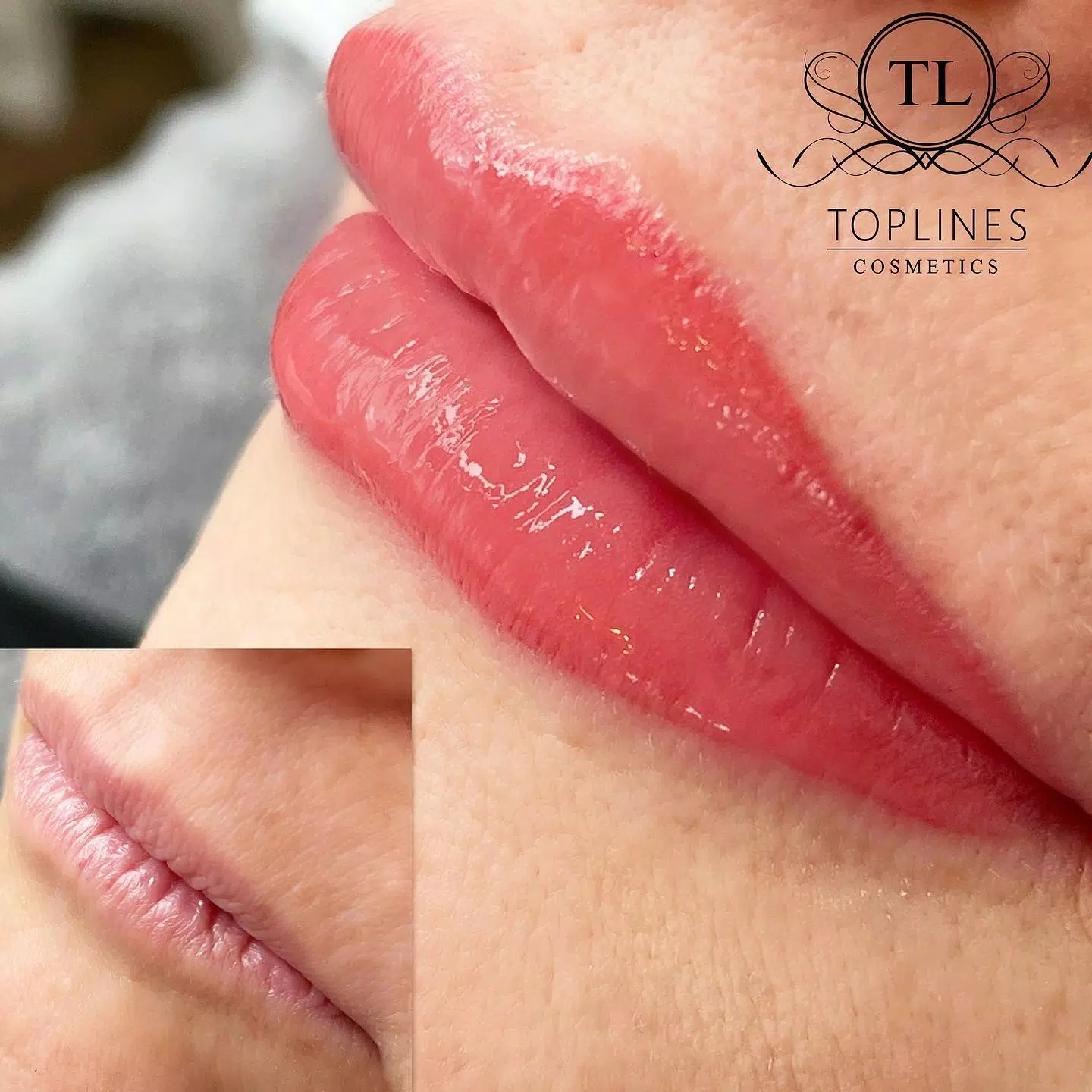 Permanent Make-Up | Lippen mit Form, Frische und Ausstrahlung
