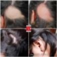  Hair-Vitalizer | Qualität auf höchstem Niveau