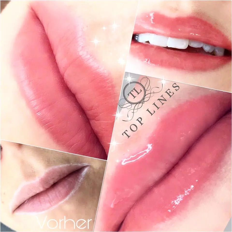 Glossy Lips 🌸
Pigmentiert ohne Lippenkonturen. 
Ein Hauch Farbe gibt den Lippen Freshness und Glowing. Willst Du auch etwas Farbe ? 
Termine gibt es unter toplines.ch